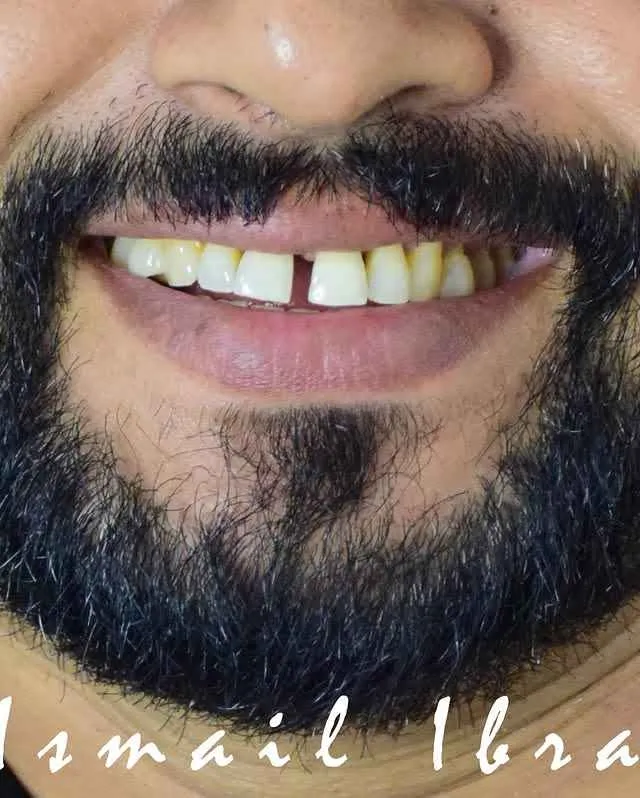 Before Transformation 3